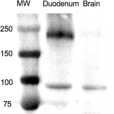 Salivary Scavenger and Agglutinin (SALSA) Is Expressed in Mucosal Epithelial Cells and Decreased in Bronchial Epithelium of Asthmatic Horses